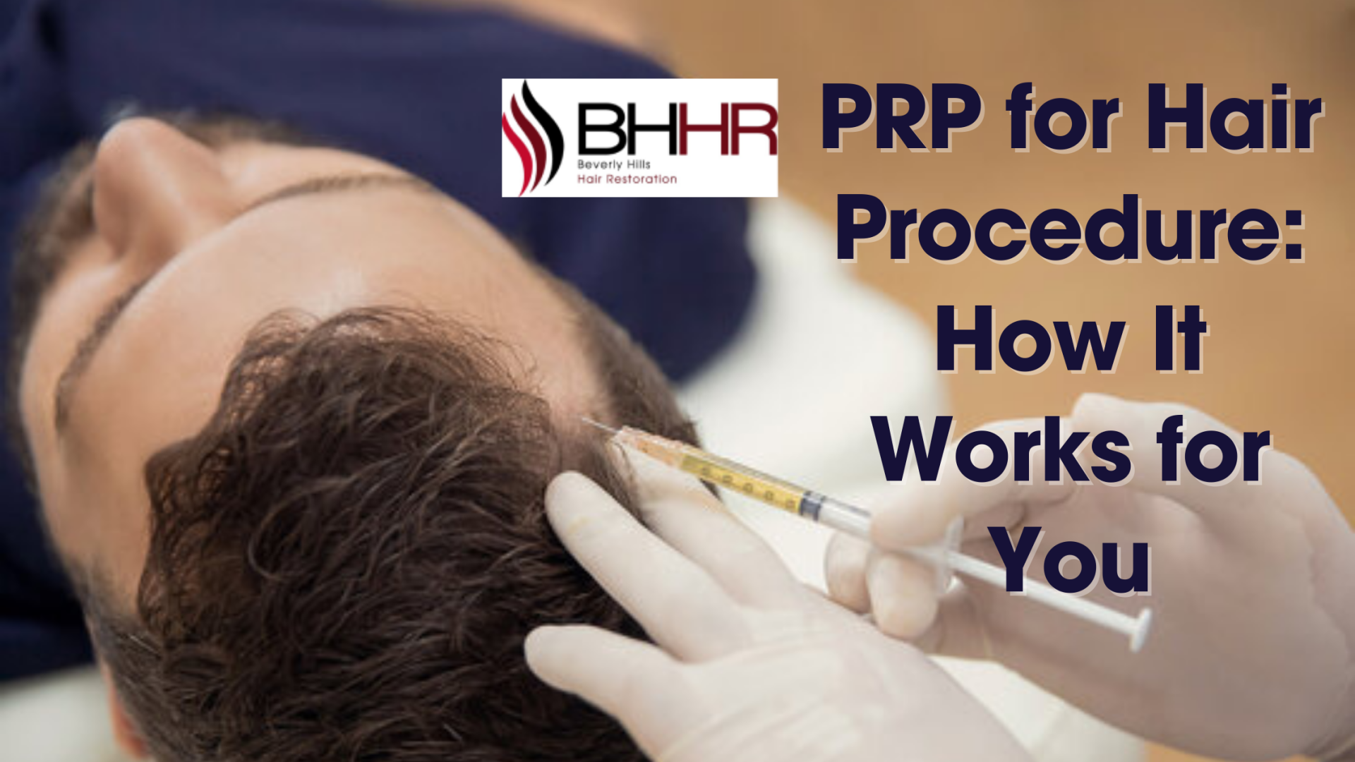 prp for hair procedure