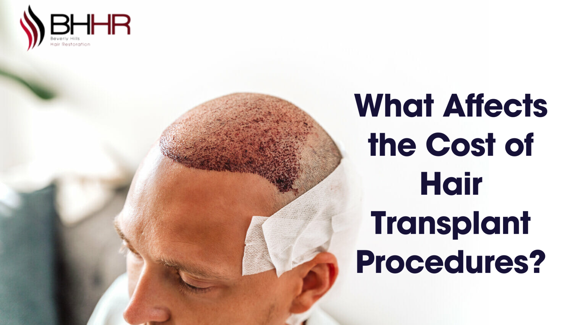 hair transplant procedure cost